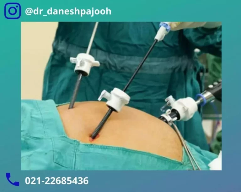 The-best-gallbladder-surgeon-drdaneshpajouh-2