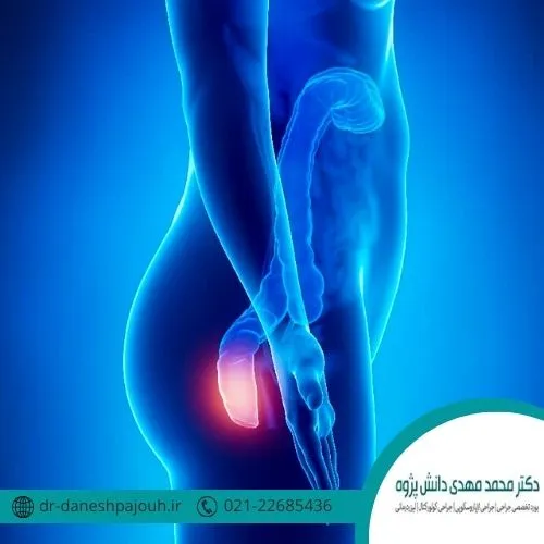 domestic-hemorrhoids-treatment