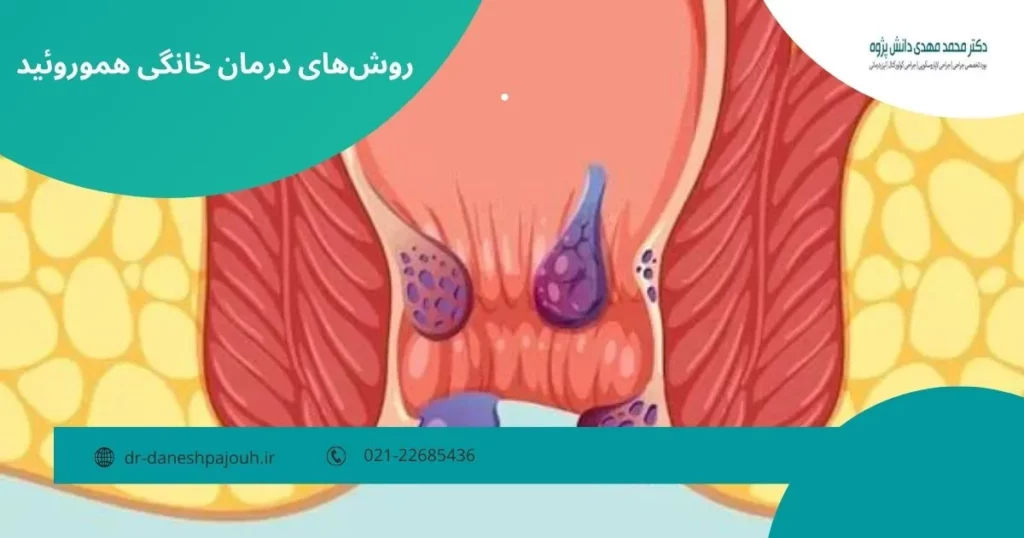 domestic-hemorrhoids-treatment