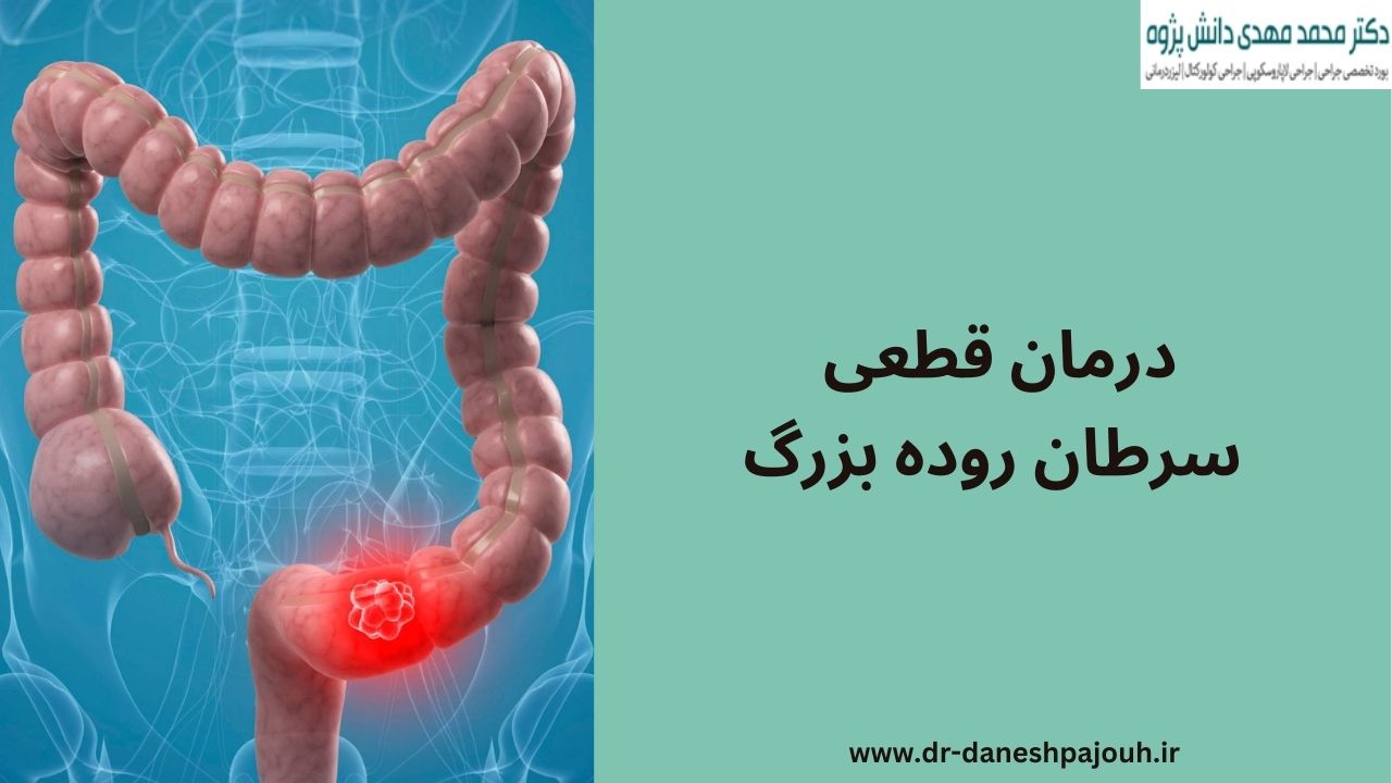 درمان قطعی سرطان روده بزرگ با دکتر دانش پژوه