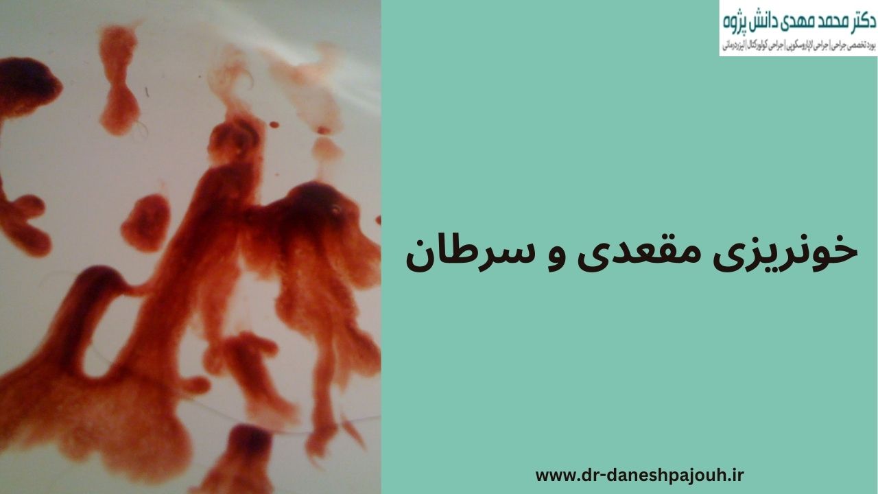خونریزی مقعدی و سرطان
