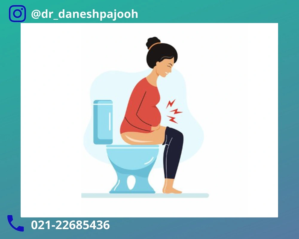 یبوست در بارداری