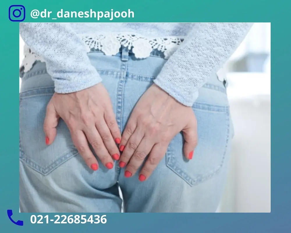 توصیه های پزشکی برای پیشگیری از شقاق مقعدی