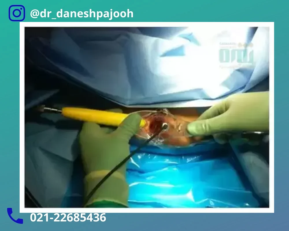 بهبودی سریع (دوره نقاهت)