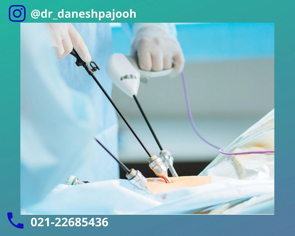 بهترین دکتر لاپاراسکوپی