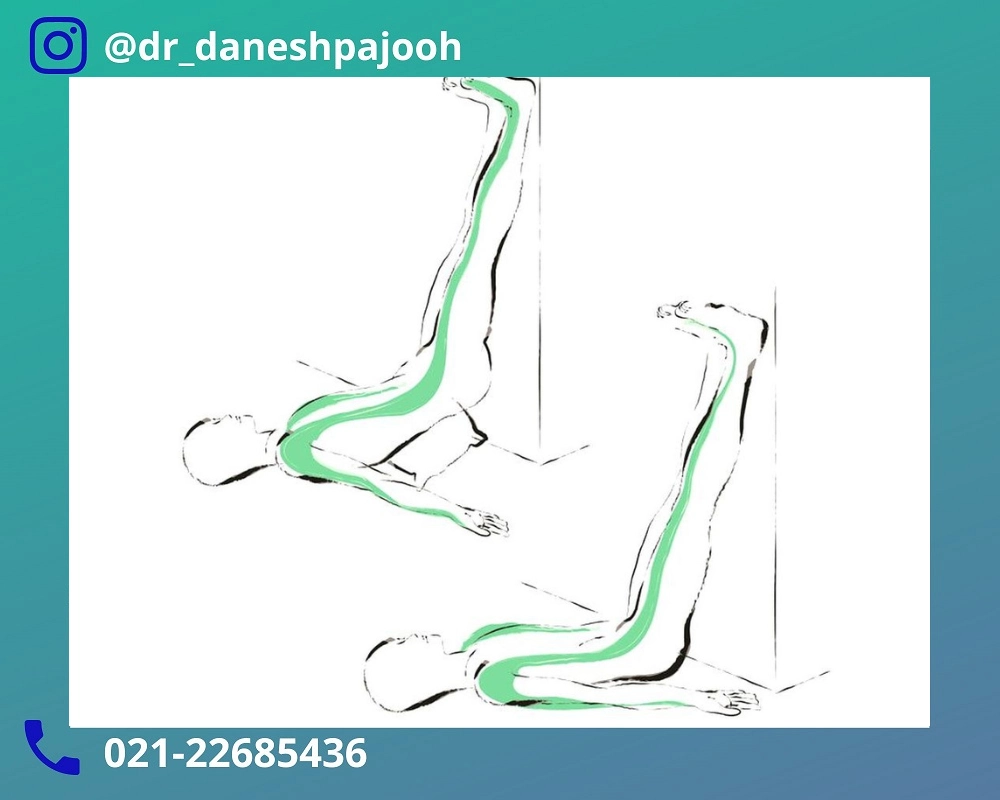 بهترین ورزش واریکوسل