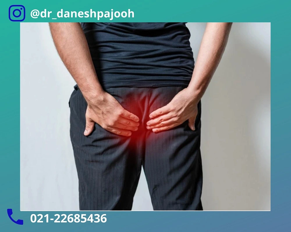 پیشگیری از ابتلا به بواسیر در مشاغل مستعد هموروئید