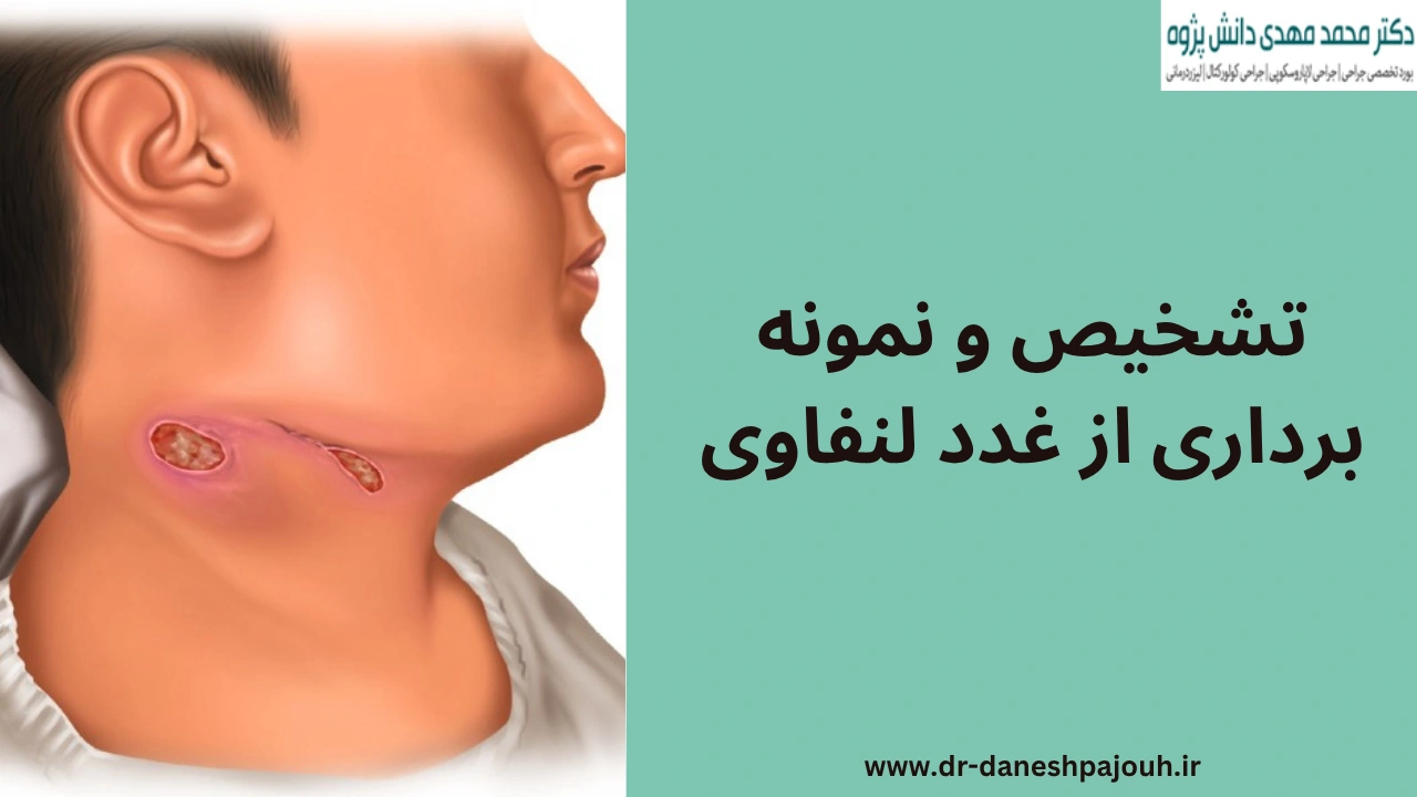 تشخیص و نمونه برداری از غدد لنفاوی