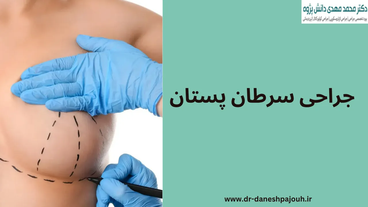 جراحی سرطان پستان