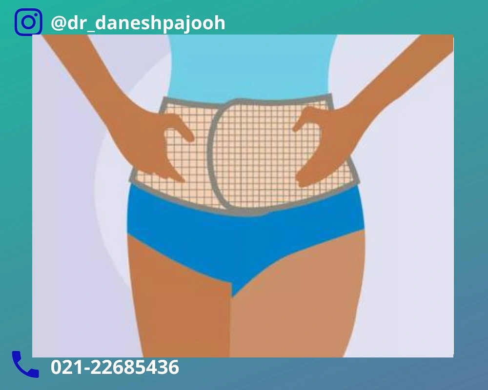 آیا مراجعه به پزشک برای یبوست بعد از زایمان ضروری است؟