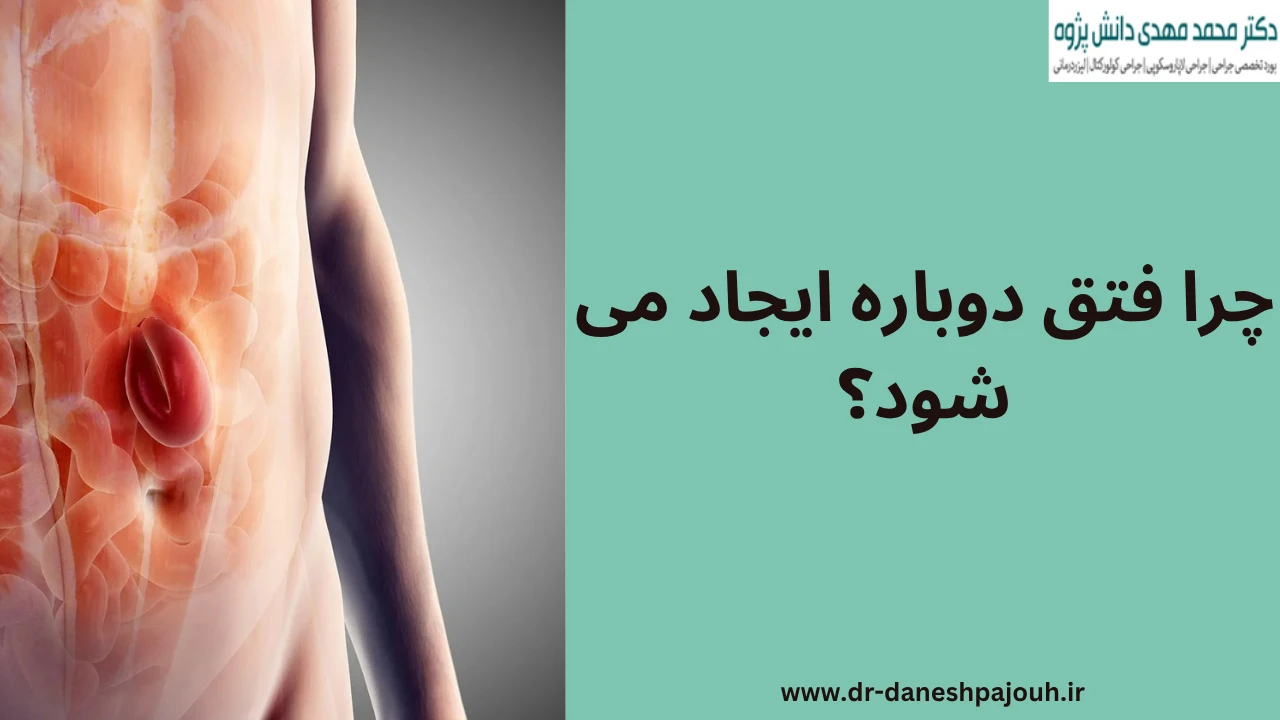 چرا فتق دوباره ایجاد می شود؟