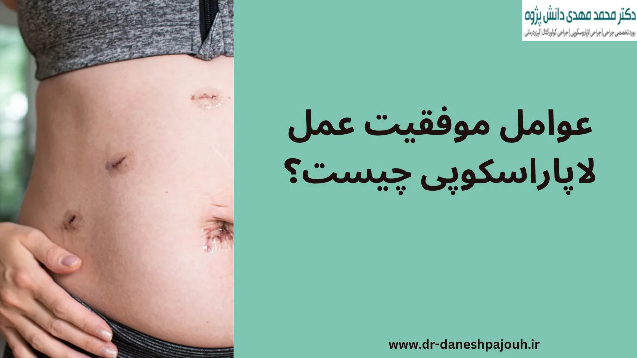 عوامل موفقیت عمل لاپاراسکوپی چیست؟